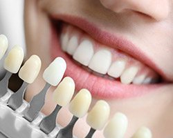 Closeup of smile compared with tooth color chart