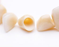 Tooth colored dental crowns prior to placement