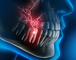 Animation of damaged tooth