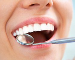 Closeup of smile during dental exam