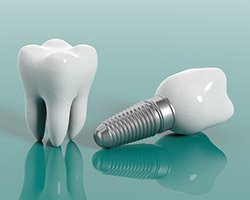 Animation of implant supported dental crown