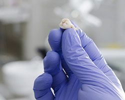 Hand holding an extracted tooth