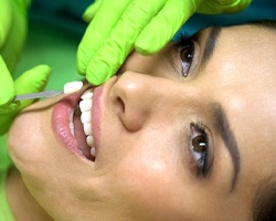 dentist placing a veneer on a woman’s tooth