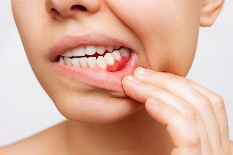 Woman with inflamed gums